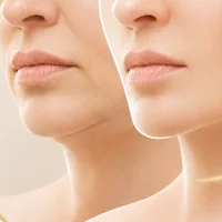 Enzimas Pb Serum